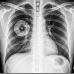 8 habits you should stop this year if you are taking Amlodipine ….and why