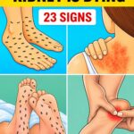These visible signs may be hiding liver disease