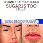 Cholesterol: 5 symptoms that warn you it’s too high(1 / 2)