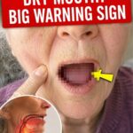 Here’s how to save a stroke patient using just a needle (1/3)